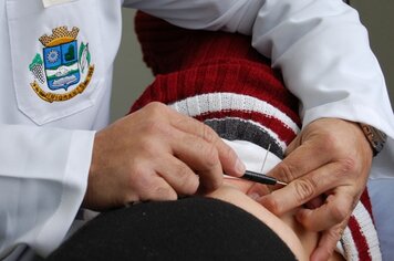 Pacientes devem fazer cadastro para acupuntura